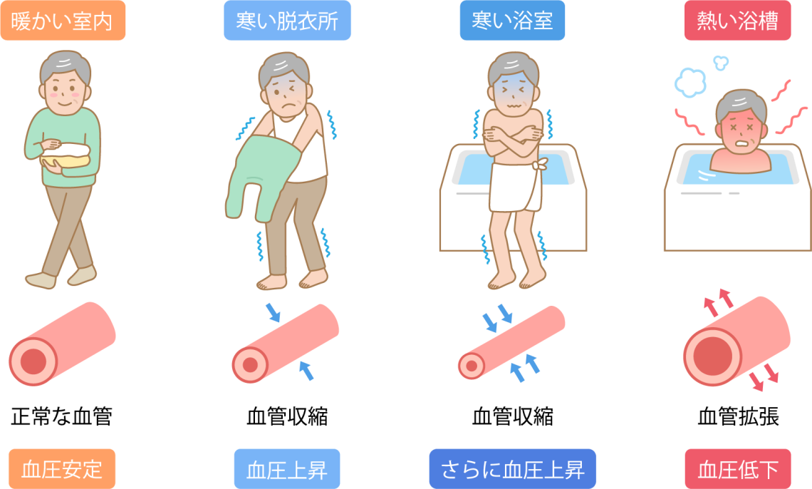 血管の状態